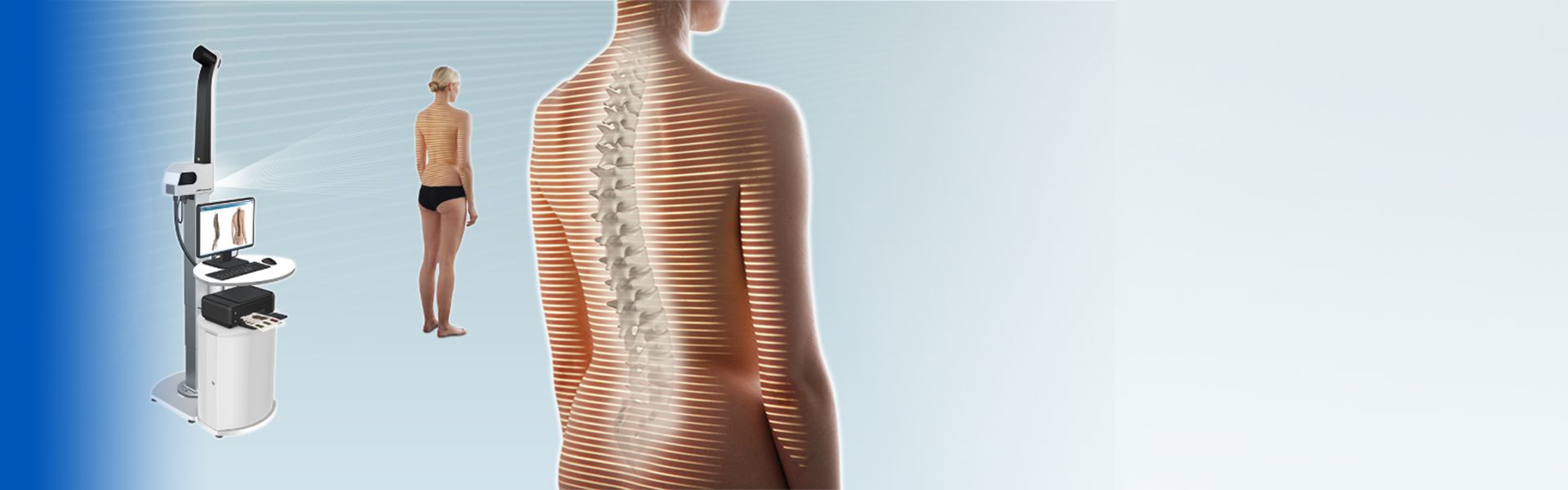 Phân tích cột sống kỹ thuật số - Digital Spine Analysis